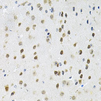 PPP1CA / PP1-Alpha Antibody