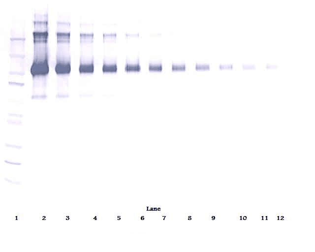 CD22 Antibody