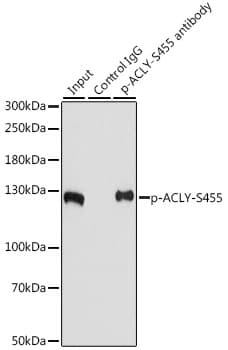 ACLY / ATP Citrate Lyase Antibody (phospho-Ser455)