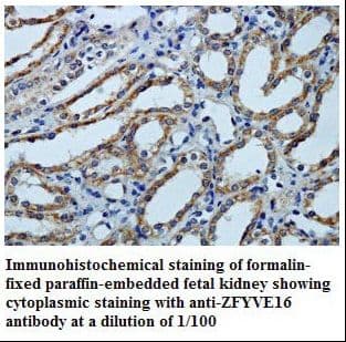 ZFYVE16 Antibody (aa369-623)