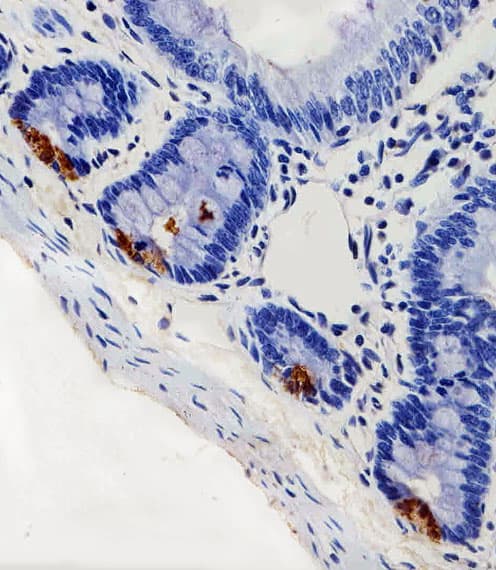 LYZ / Lysozyme Antibody (aa119-154)