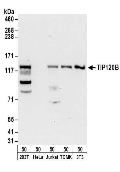 CAND2 / TIP120B Antibody (aa1186-1236)