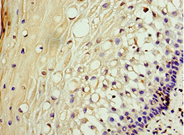 AKAP10 Antibody (aa413-662)