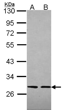SLA Antibody (aa1-276)