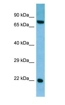 CRYGS Antibody (C-Terminus)