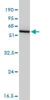 GSS / Glutathione Synthetase Antibody (clone 4B6)