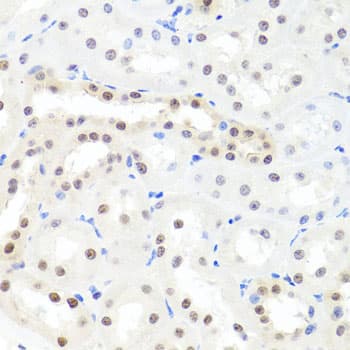 HNRNPCL1 Antibody