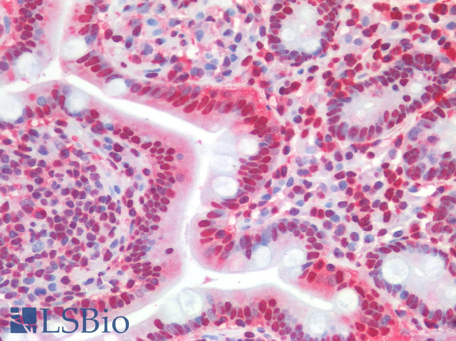 PathPlus™ NALP3 / NLRP3 Antibody