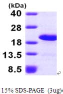 Human LSM1 Protein (Recombinant His)