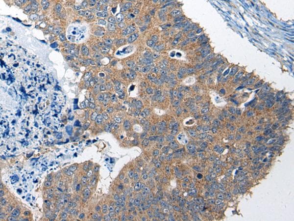 Polyclonal Rabbit anti-Human RTN4IP1 / NIMP Antibody (IHC)