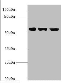 IHC-plus™ BBS4 Antibody (aa350-519)
