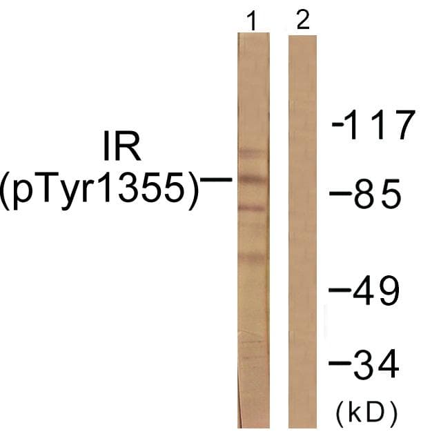INSR / Insulin Receptor Antibody (phospho-Tyr1355)