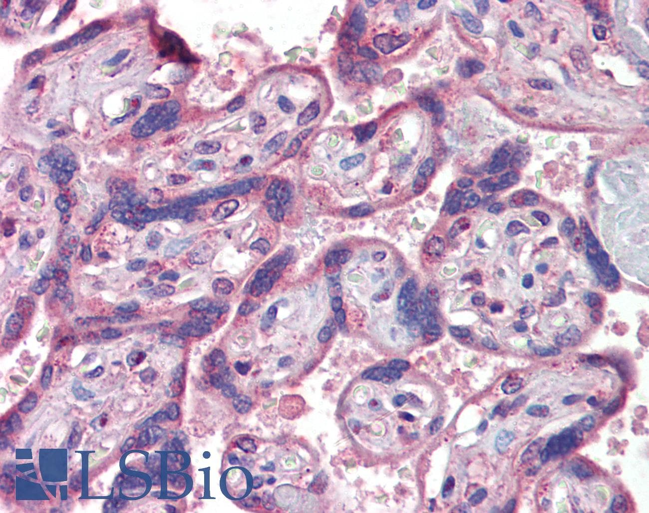 IHC-plus™ IFNAR2 Antibody (Internal Region)