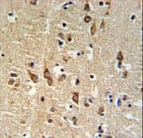 SGTB Antibody (aa71-100)