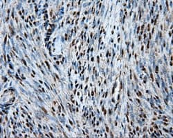 Heat Shock Protein 70 / HSPA1A Antibody (clone OTI1B2)