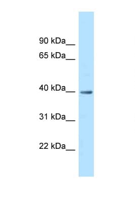 Polyclonal Rabbit anti-Human MRPS9 Antibody (aa249-298, WB)