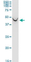 Monoclonal Mouse anti-Human BCAT1 / ECA39 Antibody (clone 1F8, WB)