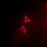 BCL2L1 / BCL-XL Antibody (phospho-Thr47)
