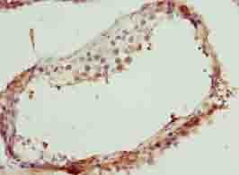 Polyclonal Rabbit anti-Human TEX35 / C1orf49 Antibody (IHC, WB)