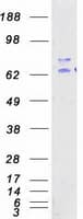 Human RIOK1 Protein (Recombinant Myc-DDK (Flag))