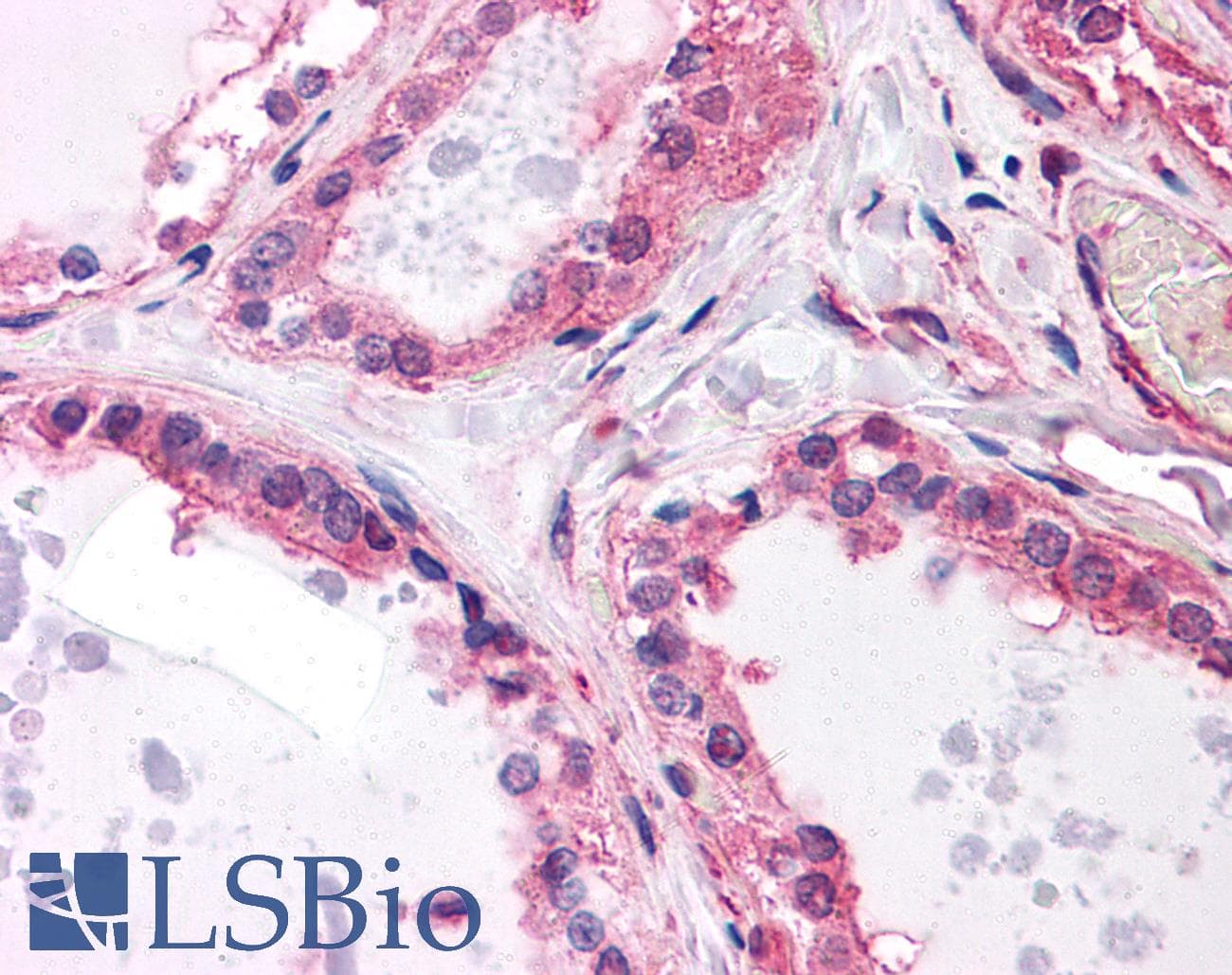IHC-plus™ Monoclonal Mouse anti-Human MCF2L / DBS Antibody (clone 1D11, IHC, WB)