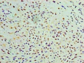 GALE / UDP-Glucose 4-Epimerase Antibody (aa1-348)