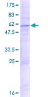 Human SLC25A47 / C14orf68 Protein (Recombinant GST)