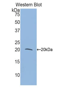 MLC2 / MYL9 Antibody (aa5-163)