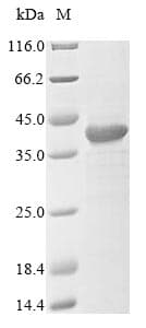 Mouse HVCN1 / HV1 Protein (Recombinant 10His, N-terminus)