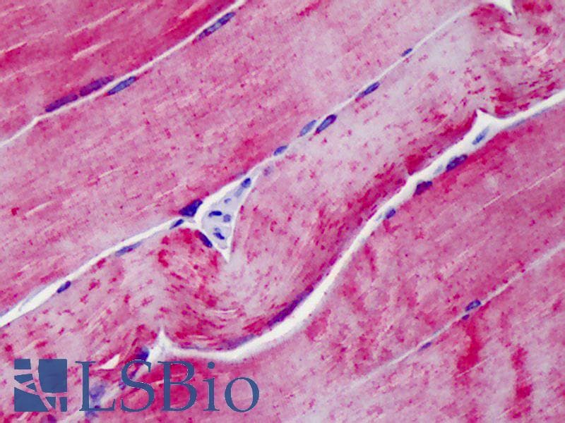 IHC-plus™ ATP2A1 / SERCA1 Antibody (clone 4B8)