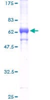Human TRIB2 Protein (Recombinant GST)