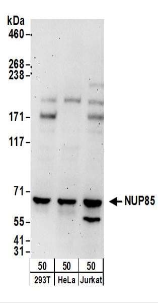 Polyclonal Rabbit anti-Human NUP85 / Pericentrin 1 Antibody (aa575-625, WB)