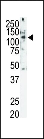 RET Antibody (aa1063-1093)