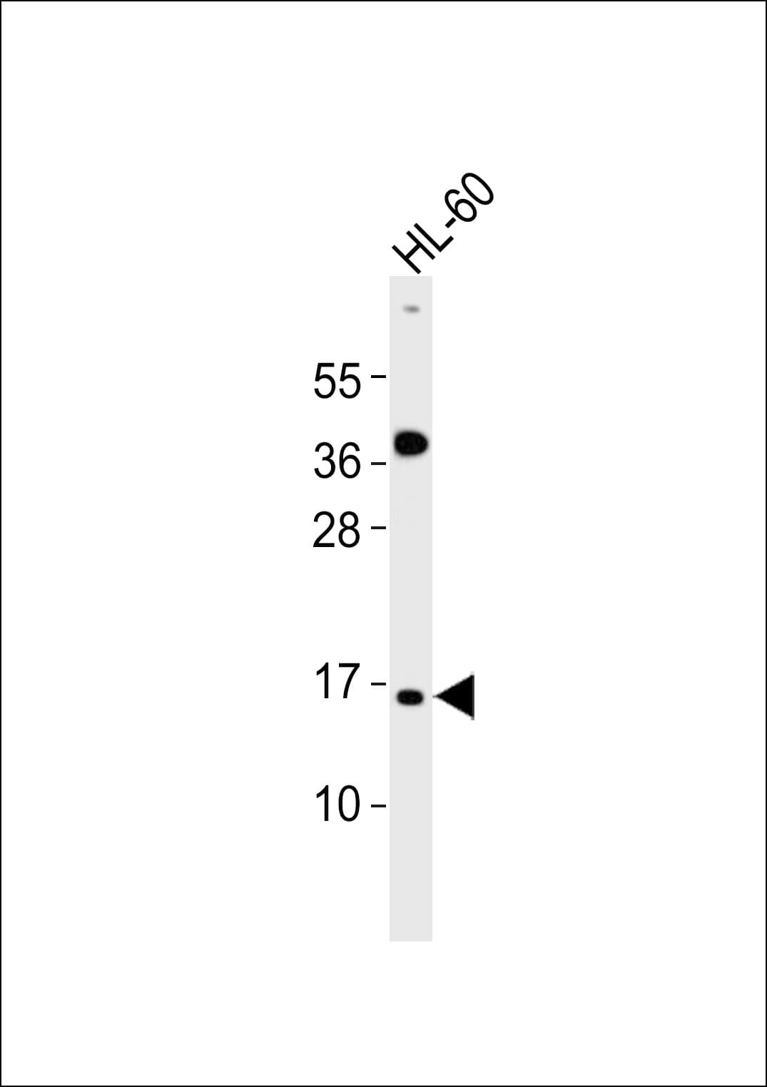 ATP5J2 / F1Fo-ATPase Antibody