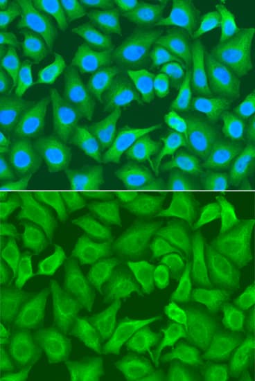 R1 / RRM1 Antibody