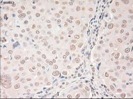 VEGFA / VEGF Antibody (clone OTI2F7)