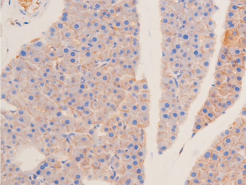 TP53 / p53 Antibody (phospho-Ser15)