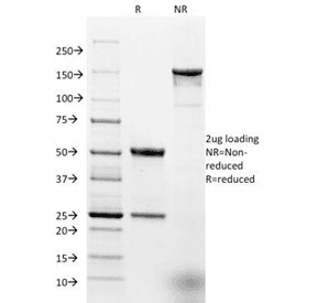 EPCAM Antibody (clone EGP40/1798, Azide-free, BSA-free)