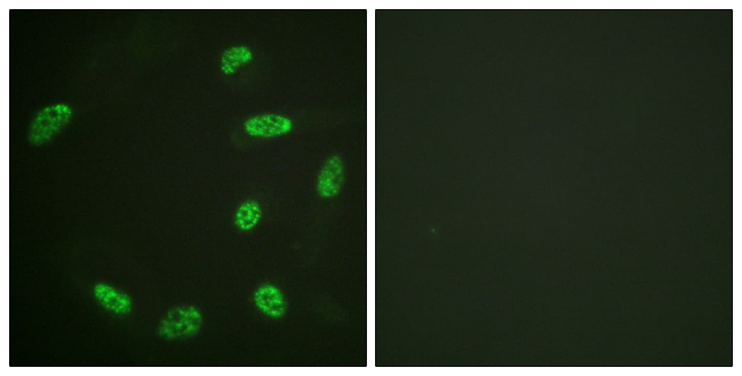 ERF / PE2 Antibody (aa492-541)