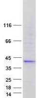 Human FBLIM1 / Migfilin Protein (Recombinant Myc-DDK (Flag))