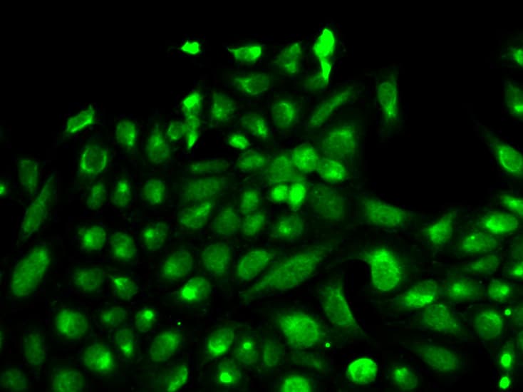 SPHK / SPHK1 Antibody