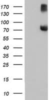 FBXO21 Antibody (clone OTI3A6)