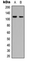 PTK2B / PYK2 Antibody (Internal)