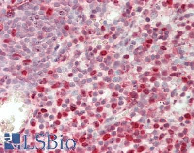 SAMHD1 Antibody (clone 2D7, Carrier-free)