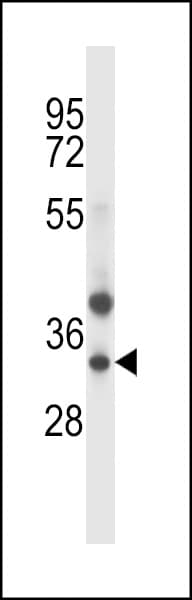 TRIM34 / RNF21 Antibody (aa67-96)