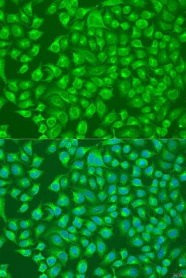 SLC12A6 / KCC3 Antibody
