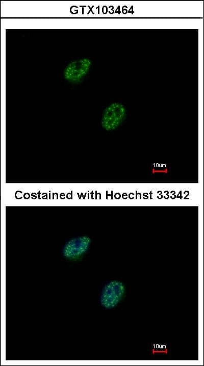 GABPB1 Antibody (aa1-395)