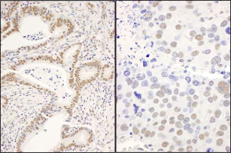 DIS / CCAR1 Antibody (aa1-50)