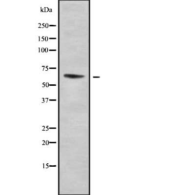 Polyclonal Rabbit anti-Human ELP3 Antibody (WB)