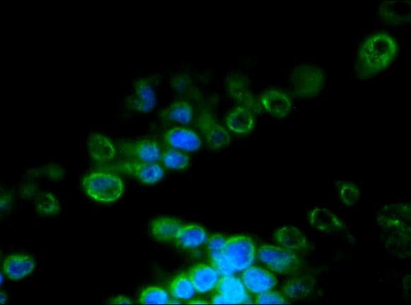 IHC-plus™ LMNB2 / Lamin B2 Antibody (clone LN43)